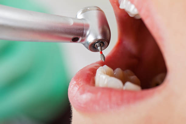 Best Emergency Cosmetic Dentistry (e.g., broken veneers) in Cherryland, CA